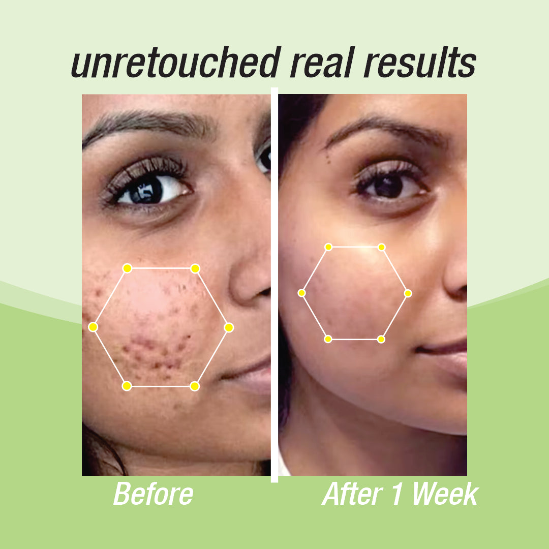 Glycolic acid serum