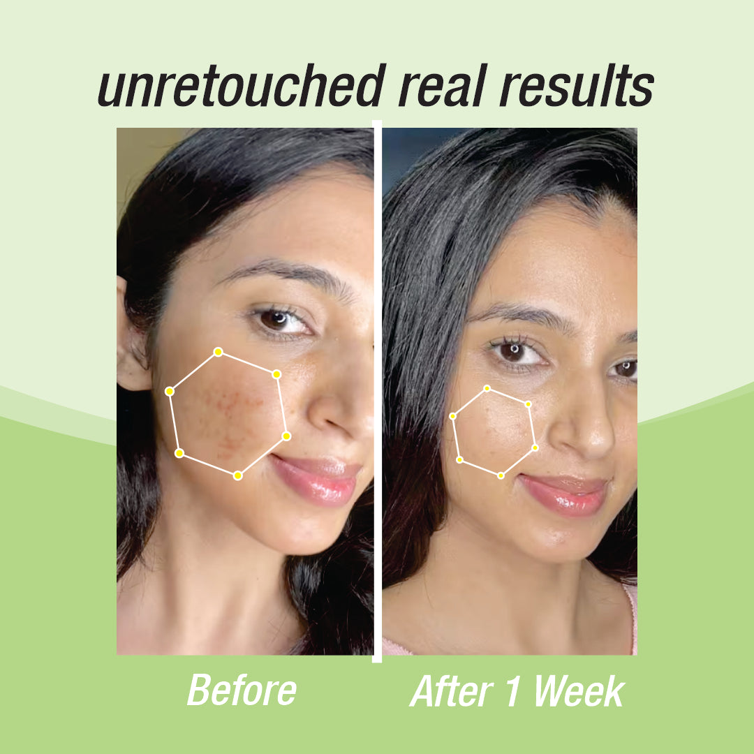 Niacinamide + zinc serum