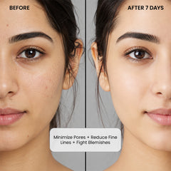 Niacinamide Face Serum